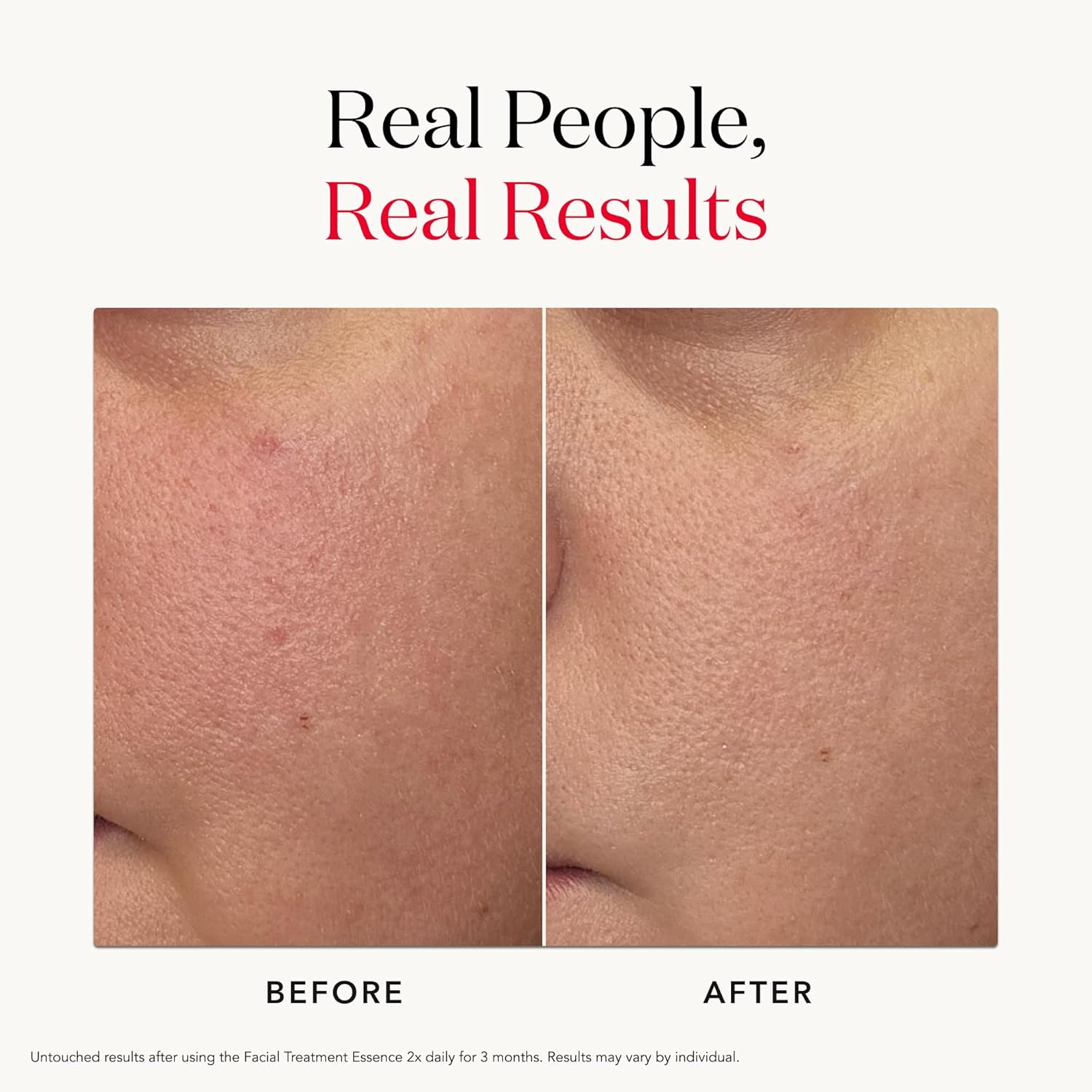 SK-II Facial Treatment Essence [30ml]	